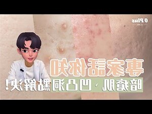 面頰 生 暗瘡